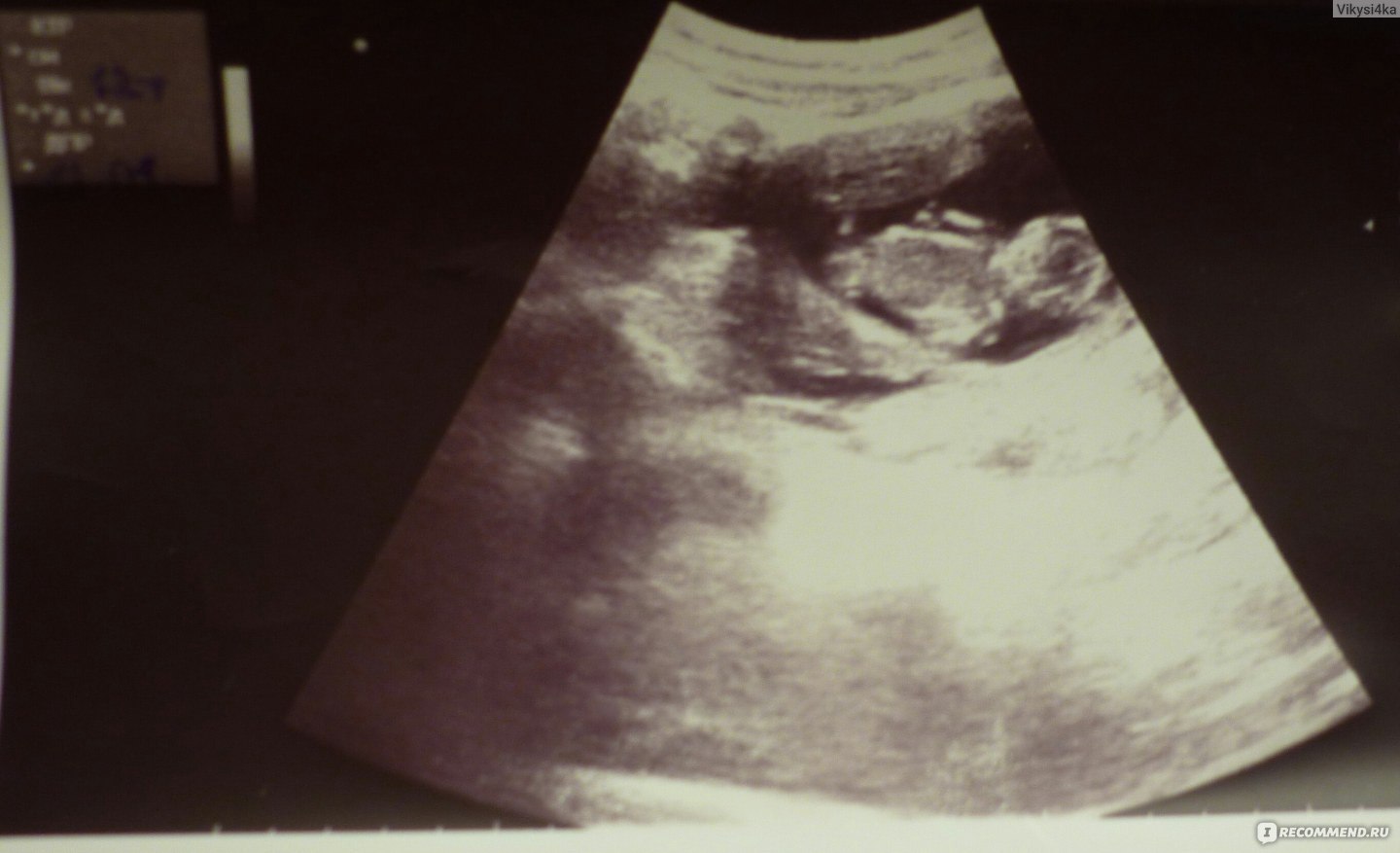 беременность 12 недель грудь уменьшилась фото 95