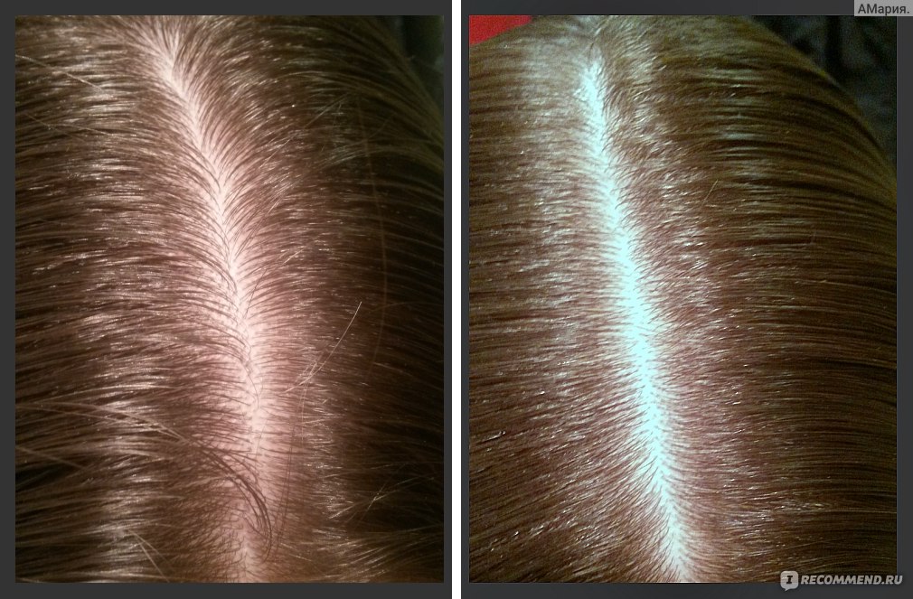 Волосы после сухого шампуня. Сухой шампунь для волос до и после. Сухой шампунь до и после до и после применения. Сухой шампунь для волос до и после фото.