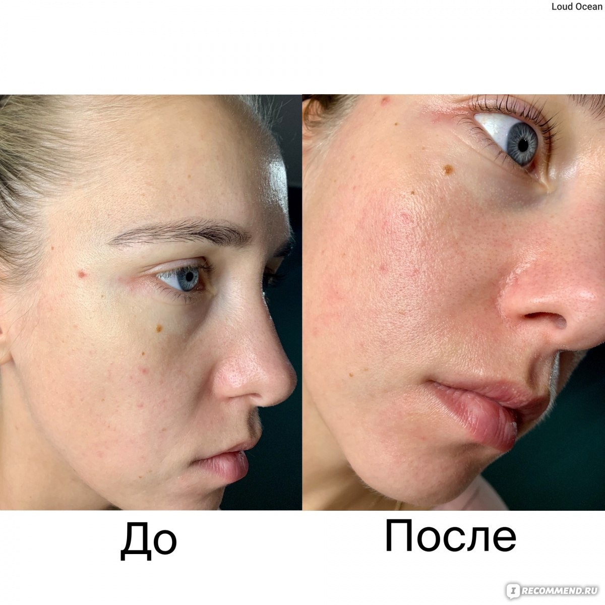 Сыворотка для лица Orjena Vitamin c bright intensive serum фото