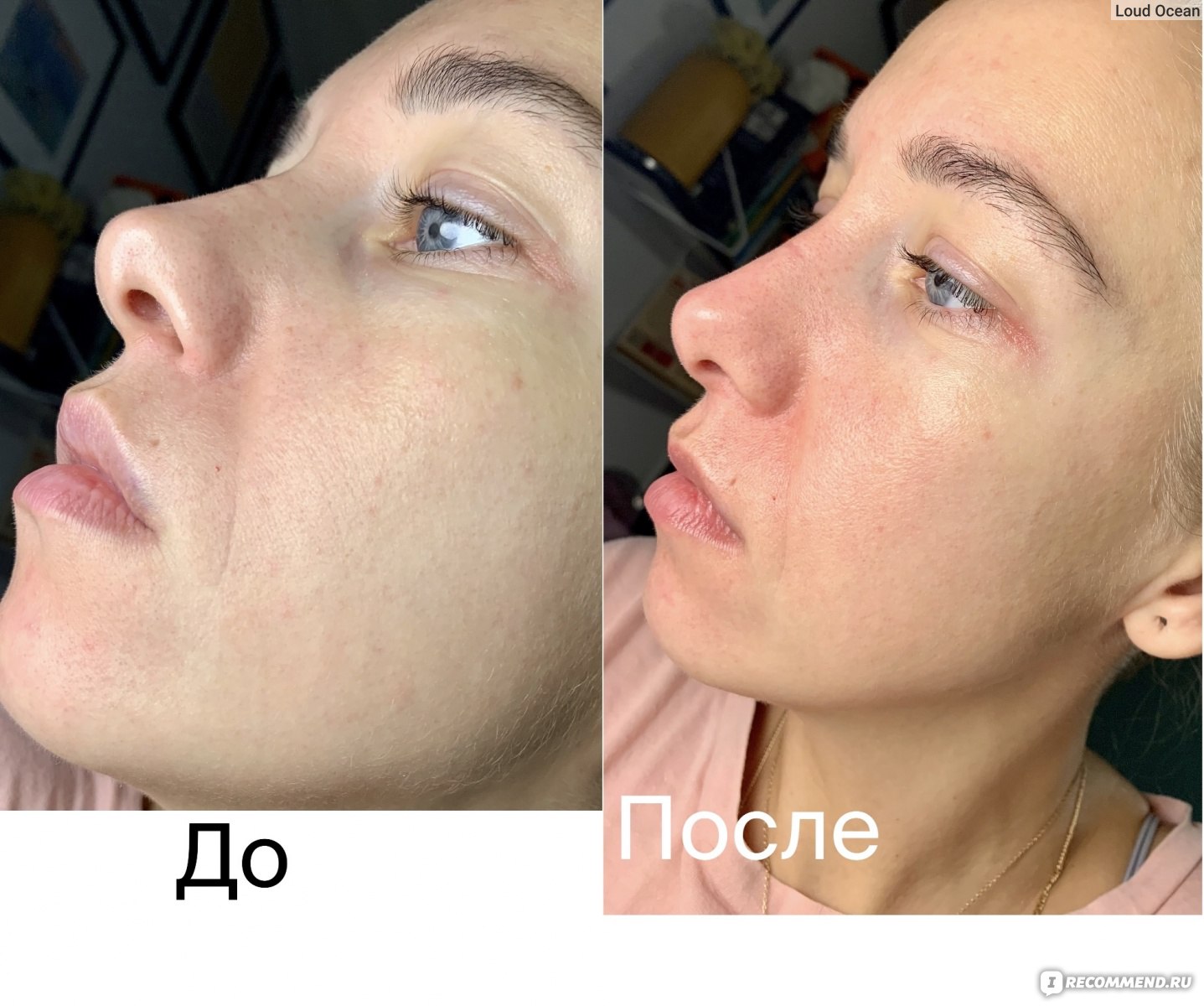 Сыворотка для лица Orjena Vitamin c bright intensive serum фото