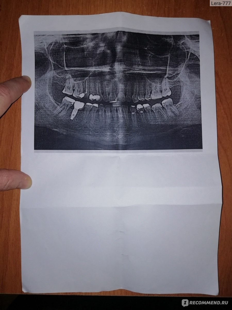 Crystal Clinic (Кристалл Клиник) на Ерошевского 18, Самара - «Я у них была!  Провела там 2,5 часа... Что я думаю о панорамном снимке, который они  бесплатно выдают на руки, и вообще об