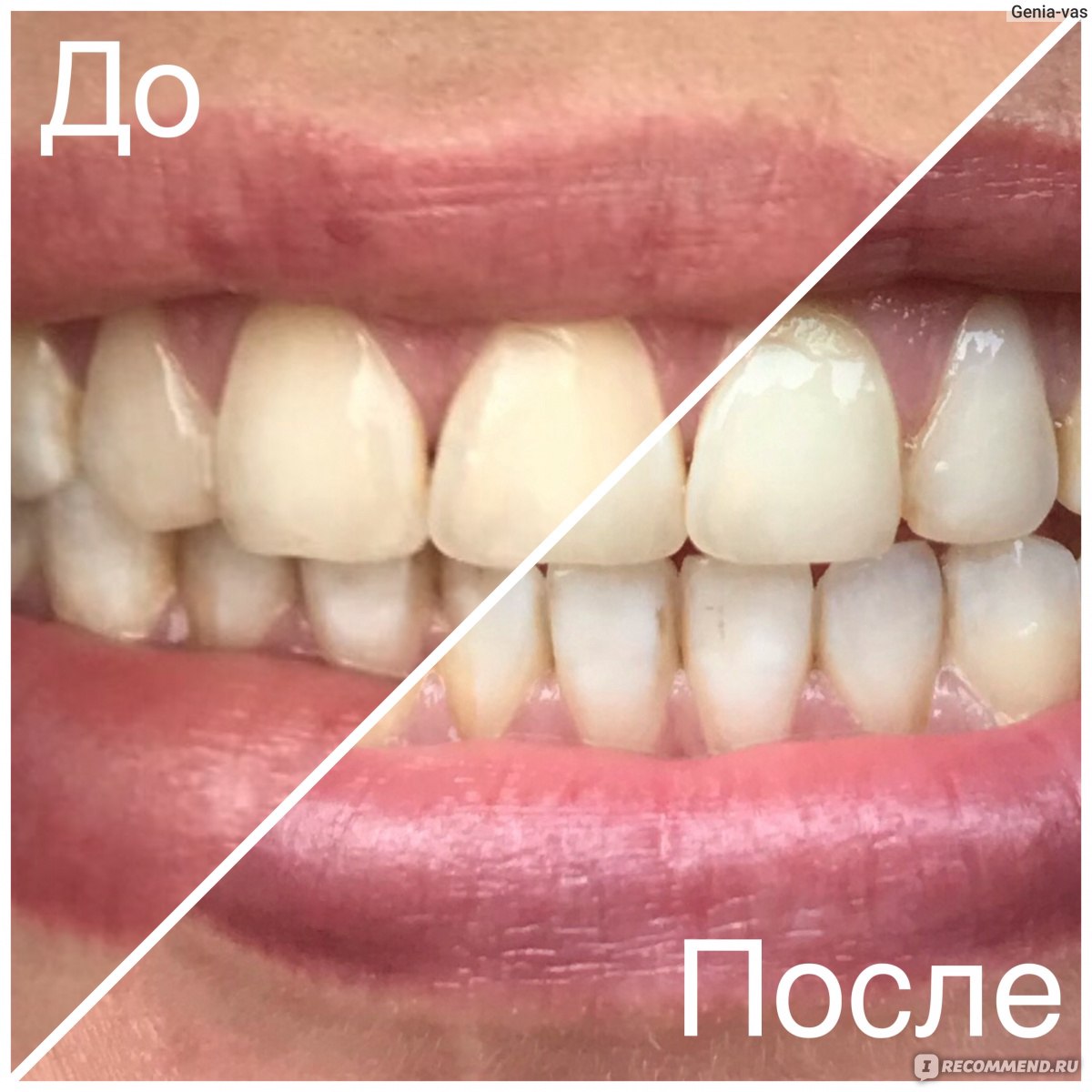 Пудра для отбеливания зубов White&Smile (Powder for Teeth Whitening) -  «Думаете, что отбелить зубы пастой не реально? Вы правы. Сделать это можно  специальной пудрой White&Smile! » | отзывы