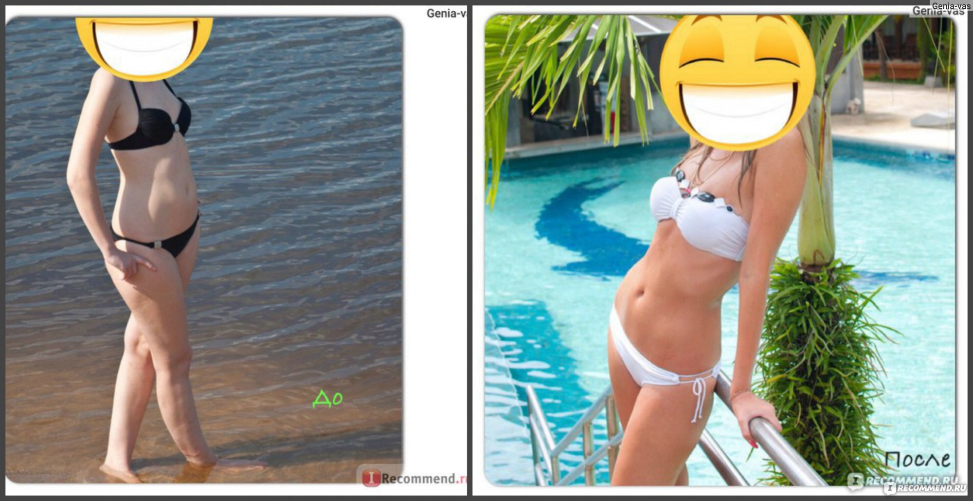 Неинвазивный тест НИПТ  фото