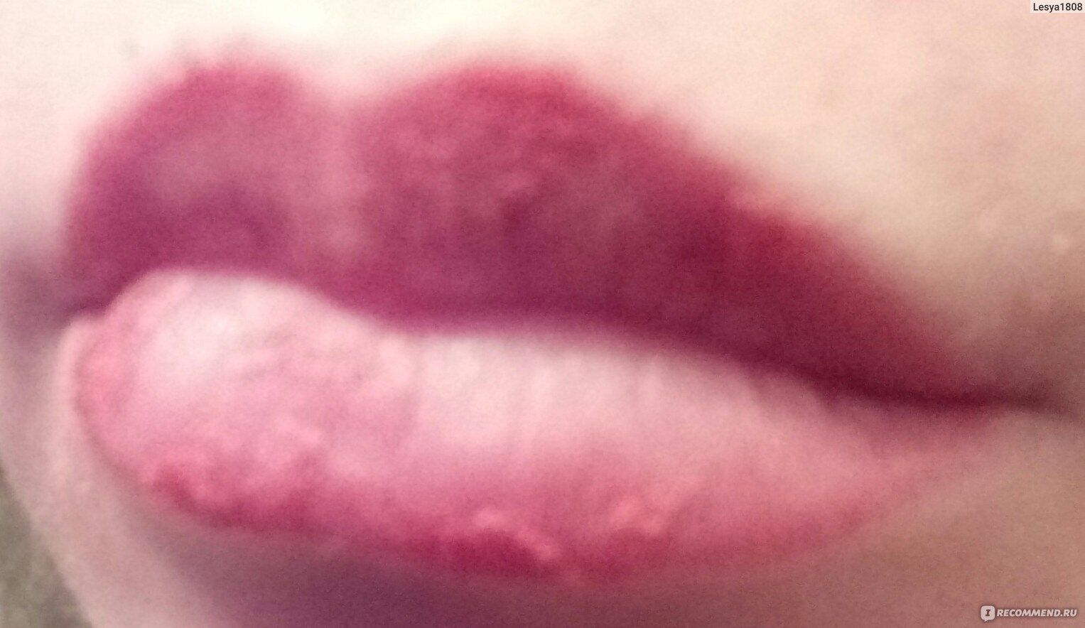 Корочки после перманентного макияжа губ