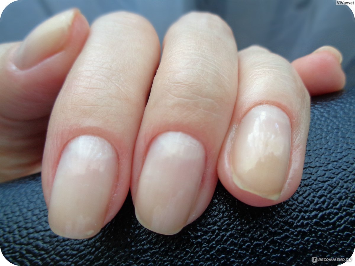 Средство для слоящихся ногтей  ORLY Nail Defense фото