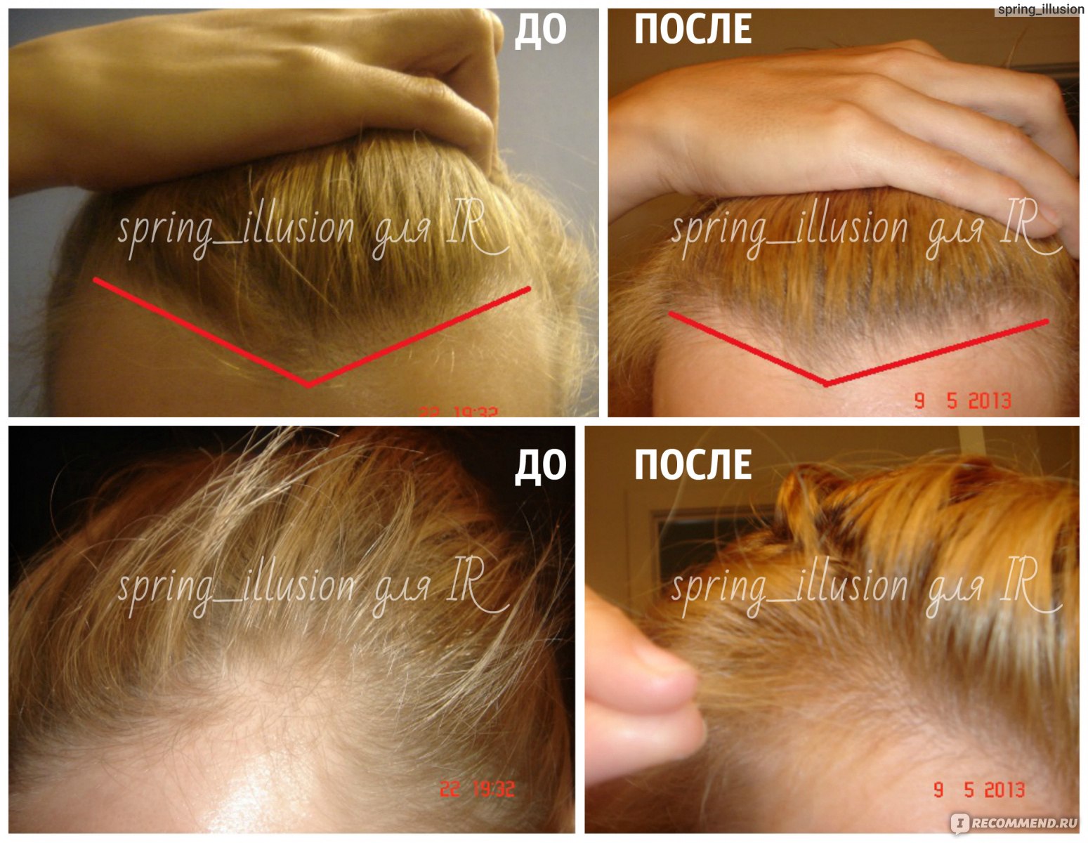 Средство от выпадения волос DS Laboratories Spectral F7 Astressin-B Topical Booster фото