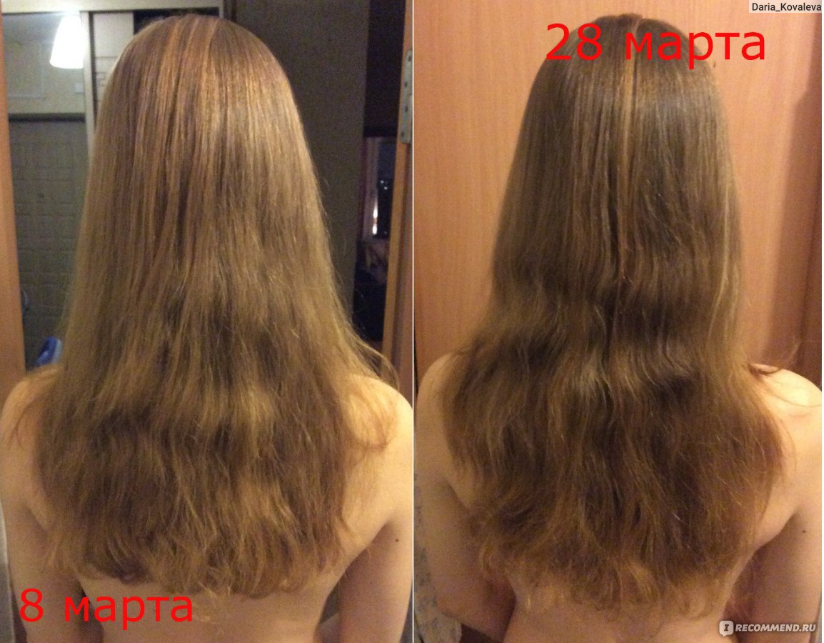 Рост волос за месяц фото