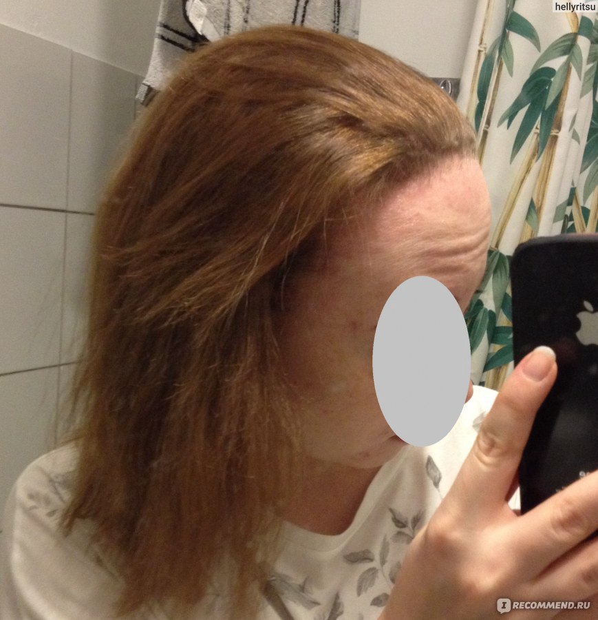 Восстановление волос после химиотерапии - интернет магазин париков BonParik