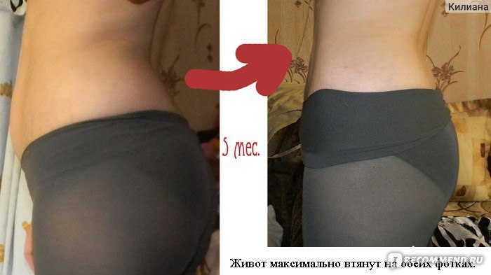 Как меняются лица сильно похудевших девушек? Гагарина, Адель. Фото до и после