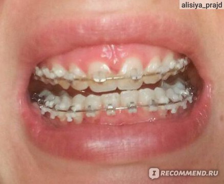 Как в brackets сделать два окна