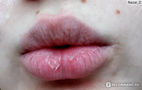 Что можно сделать с губами