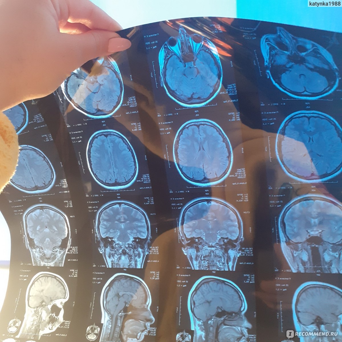 магнитно-резонансная томография. самочувствие после мрт. как делают кт. пкс коленного сустава мрт. опасное мрт.