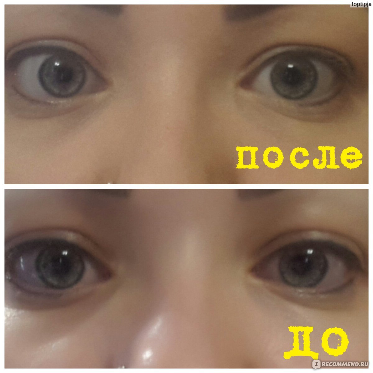 Отбелить глаза в домашних условиях. Капли отбеливающие белки глаз Окуметил. Окуметил отбеливает глаза. Отбеливающие капли для глаз до и после. Окуметил глаза до и после.