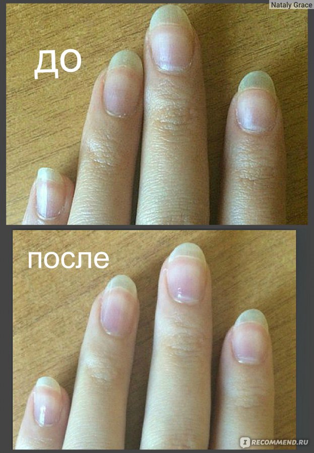 Как быстро отрастить ногти - ответов на форуме sauna-ernesto.ru ()