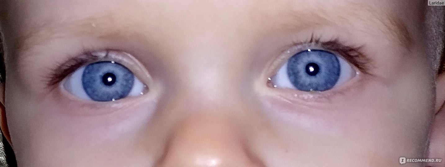 Что делать, когда у ребенка закисают глаза?