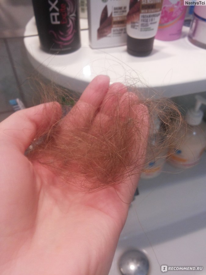 Почему выпадают волосы после мытья. Норма выпадения волос. Норма выпадения волос на голове. Норма выпадения волос у женщин. НАРИА выпадения волос в день.