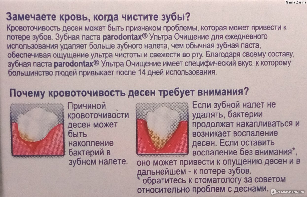 Могут ли зубы давать температуру. Кровотечение десен и зубов.