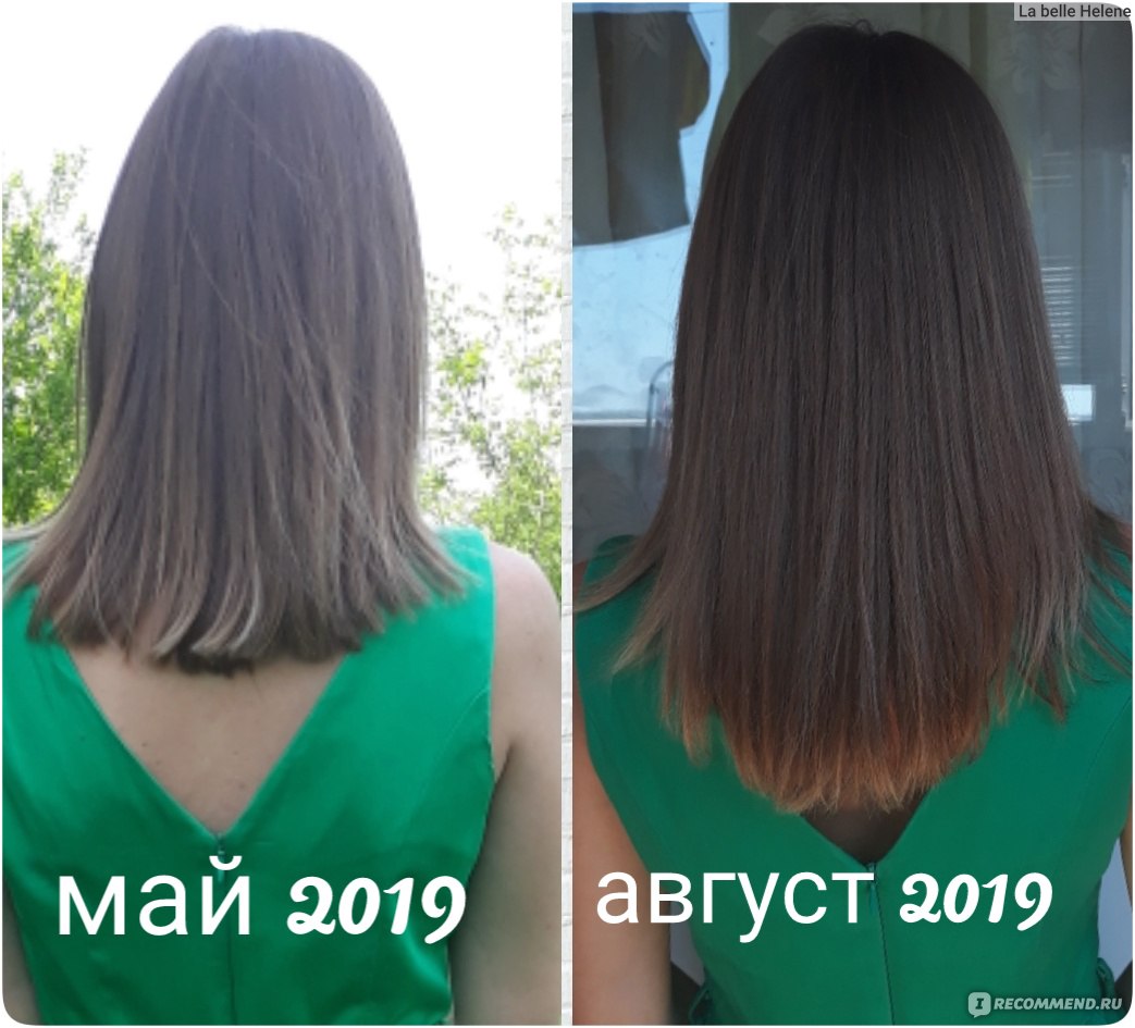 Сколько волос вырастет за 3 месяца. Рост волос за месяц. Волосы отрасли до и после за год. Волосы отрасли за три месяца. Рост волос по месяцам.