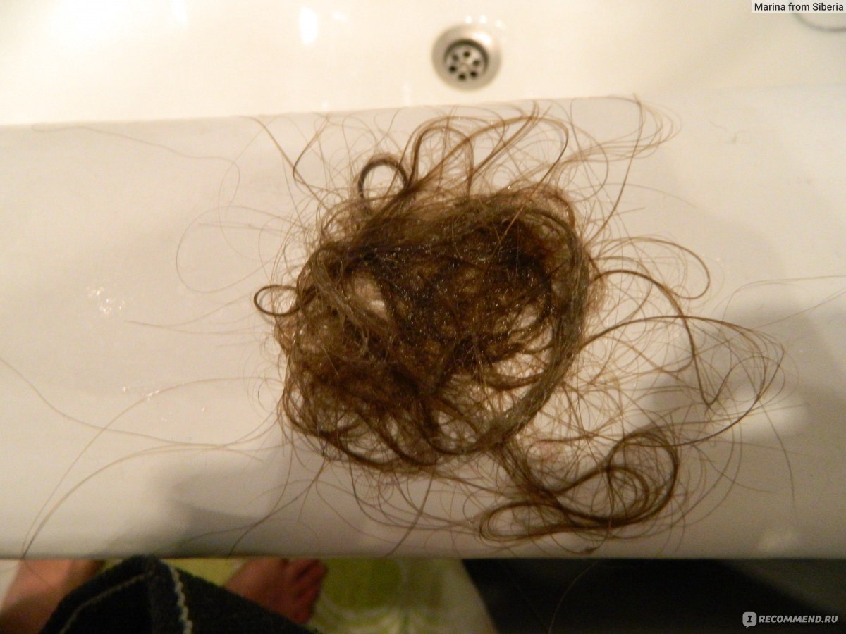 После коронавируса выпадают волосы. Выпадают волосы после коронавируса. Коричневые выпавшие волосы.
