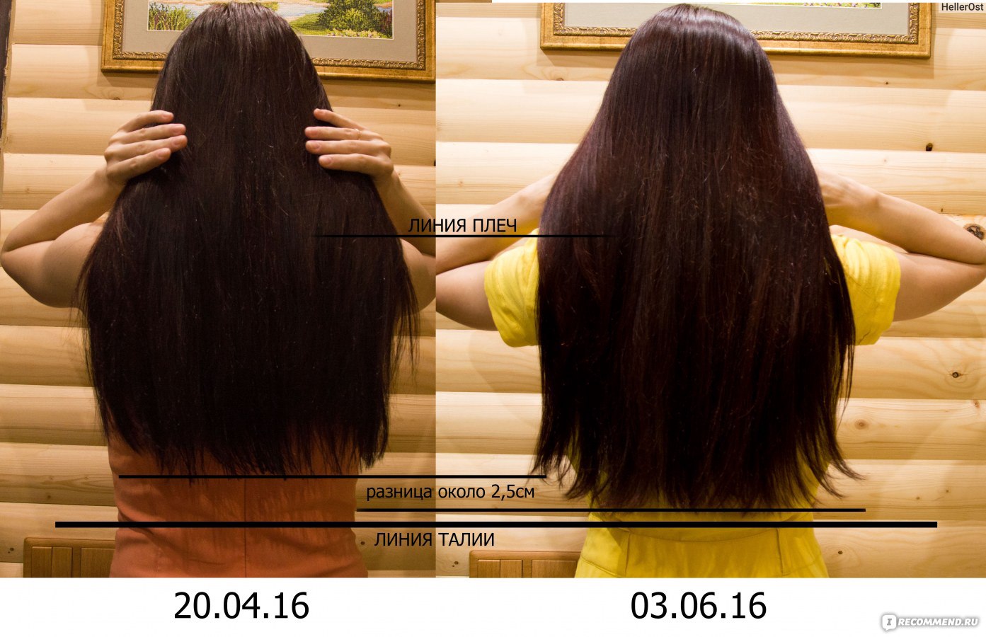 Волосы до и после масок для роста волос