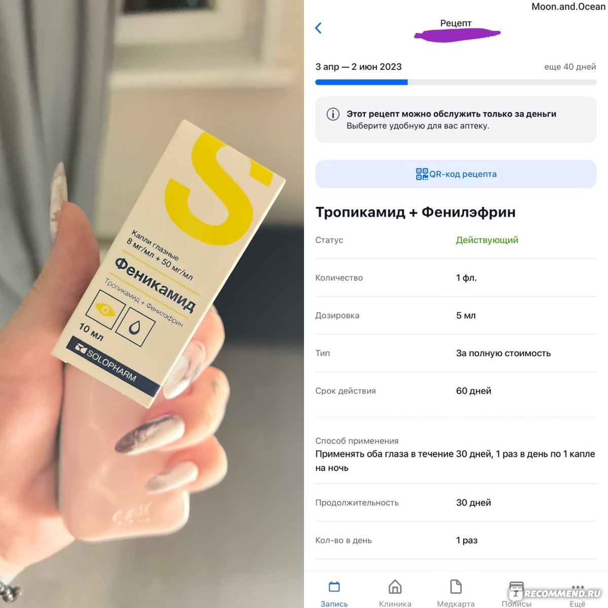 Капли для глаз Solopharm Феникамид (Тропикамид 8,0 мг) - «Упало зрение?  Назначим эти капли в глаза! Врачи не перестают пичкать меня рецептурными  препаратами. » | отзывы