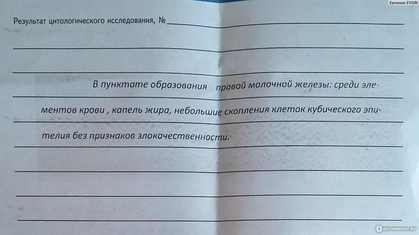 УЗИ (Ультразвуковое исследование) молочных желез - «УЗИ тоже ОШИБАЕТСЯ  порой! Фуф!!! В моём случае - к лучшему! История о том, как после ДВУХ  (!!!) УЗИ молочных желез (период ЛАКТАЦИИ) я натерпелась страха