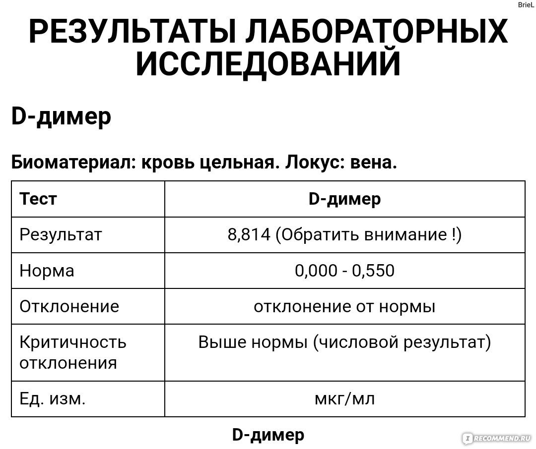 Средства д/улучшения мозгового кровообращения Bayer Ксарелто (Ривароксабан)  - «Ксарелто - лекарство спасающее жизнь! Полтора года на антикоагулянтах, 8  месяцев на Ксарелто! С какими побочками пришлось столкнуться и к чему нужно  быть готовым