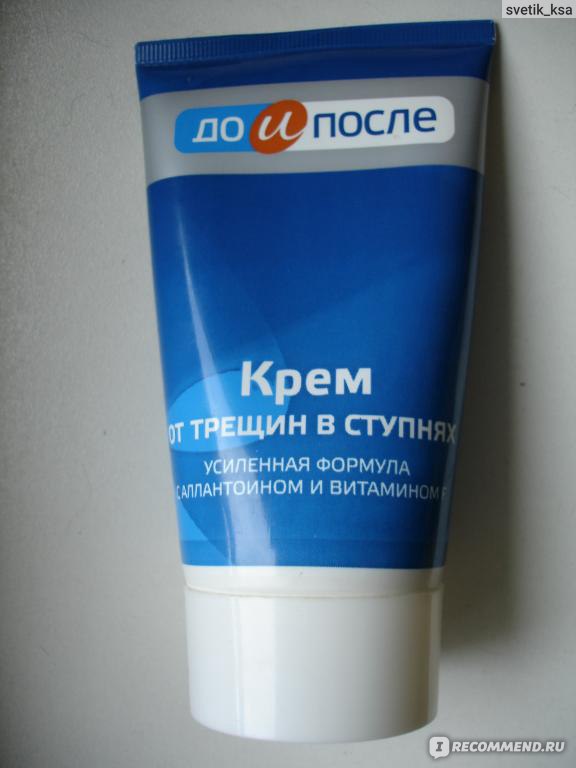 Крем от трещин в ступнях Твинс Тэк До и После усиленная формула с ...