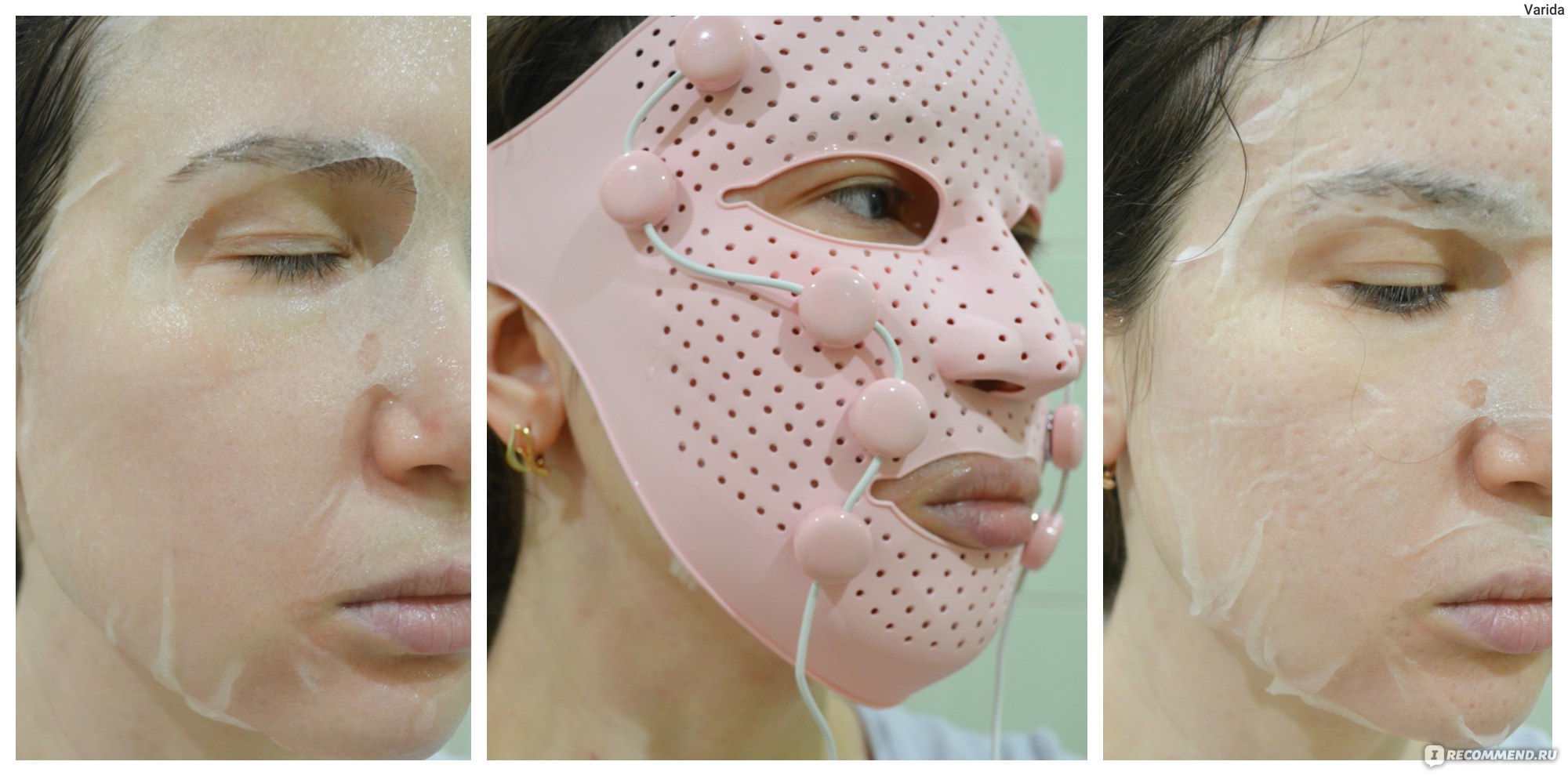 Карбоновая маска для лица – польза и эффективность