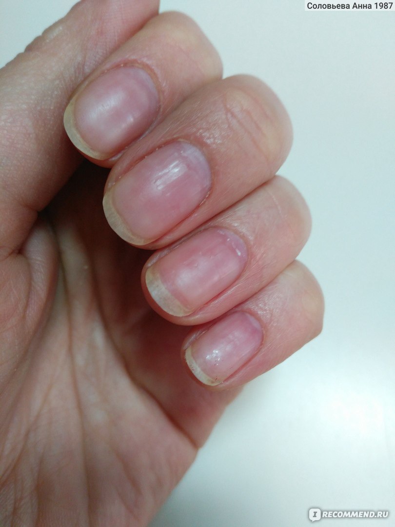 Как восстановить ногти после гель-лака и наращивания?