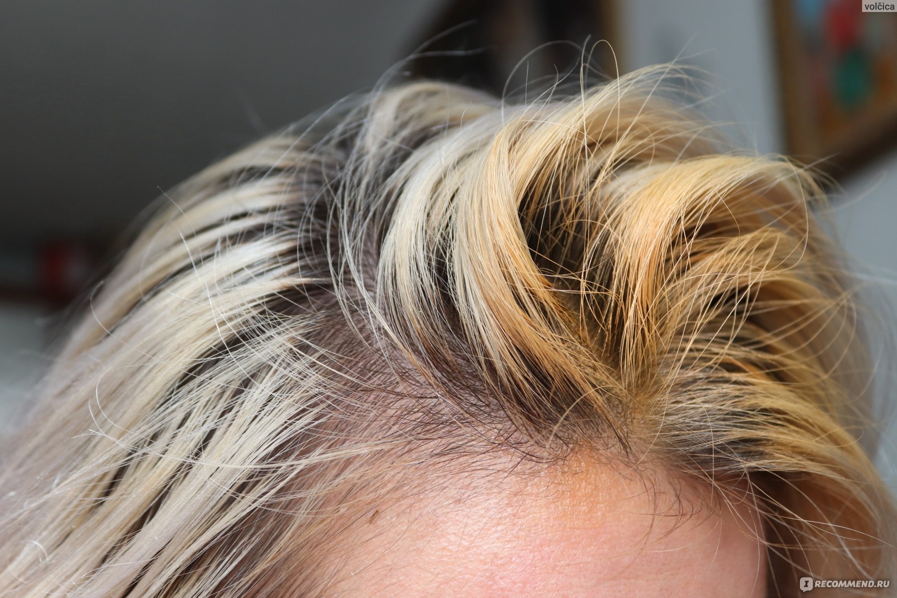 корни волос у блондинок фото
