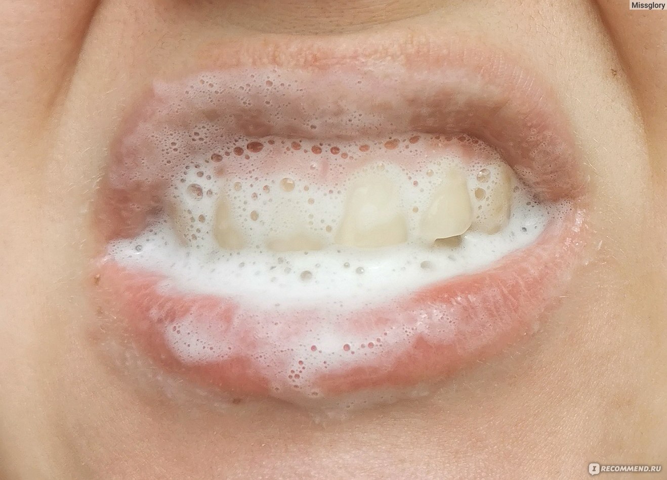 Зубная паста R.O.C.S. Sensitive "Мгновенный эффект", 94 гр фото