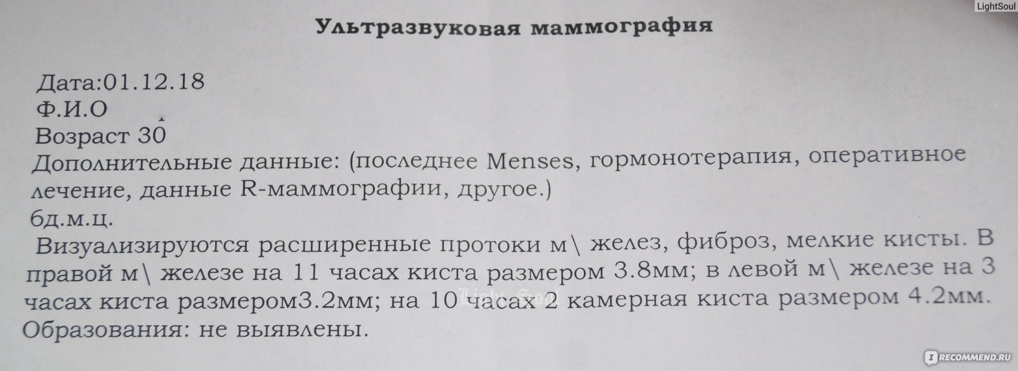 БАД Mirax Индинол - «Индинол при фиброзно-кистозной мастопатии. Оказывает  ли влияние на кисты? Результаты УЗИ ДО и ПОСЛЕ. Вагон и маленькая тележка  побочек, которые сильно влияют на качество жизни. » | отзывы