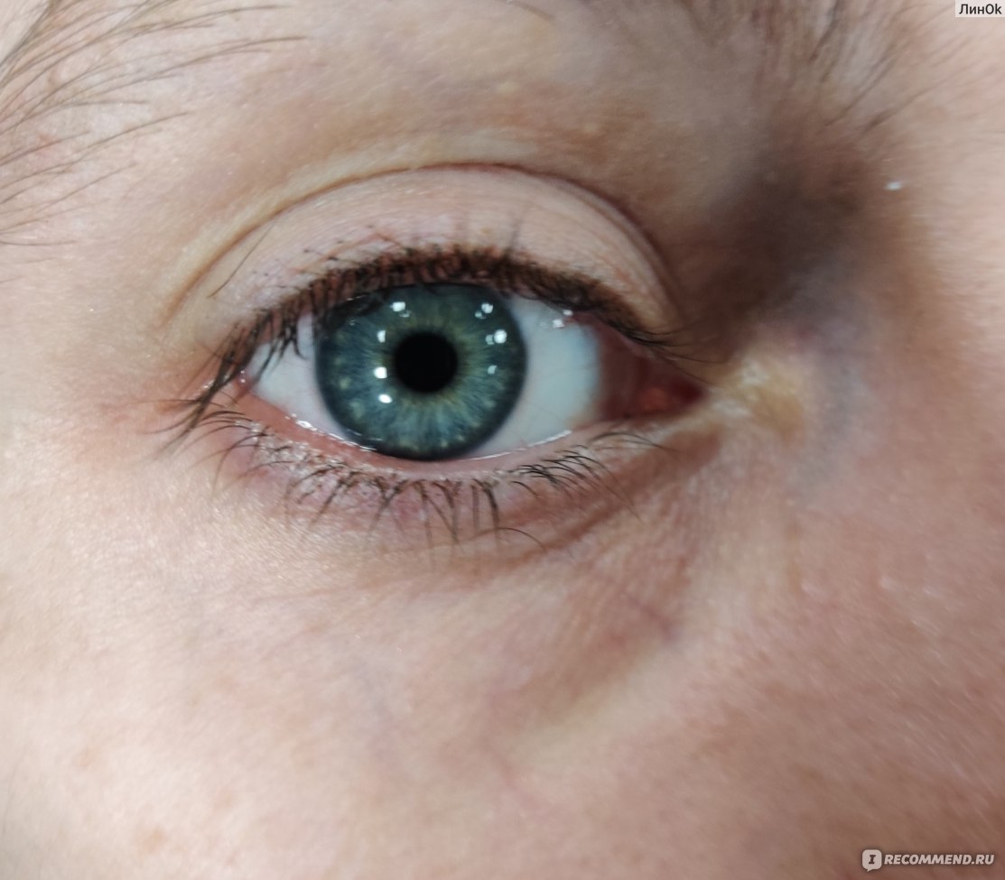 Средство для снятия макияжа с глаз ООО «Гельтек-Медика» Блефарогель очищение фото