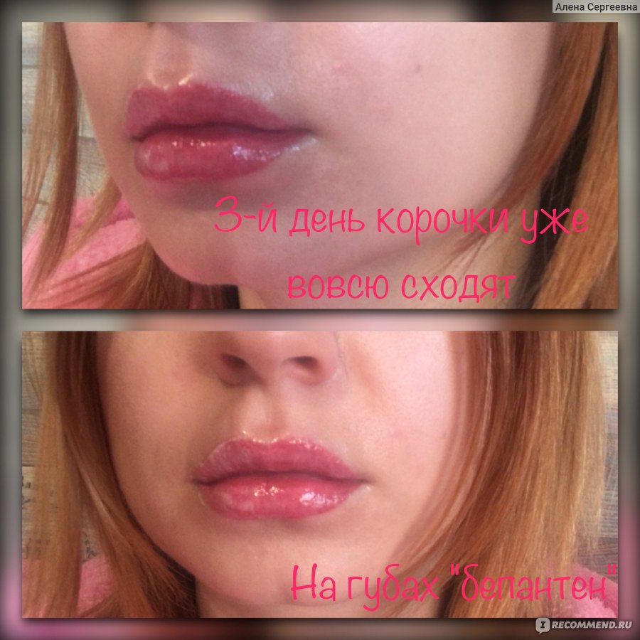 Как заживает перманентный макияж губ по дням фото корочки