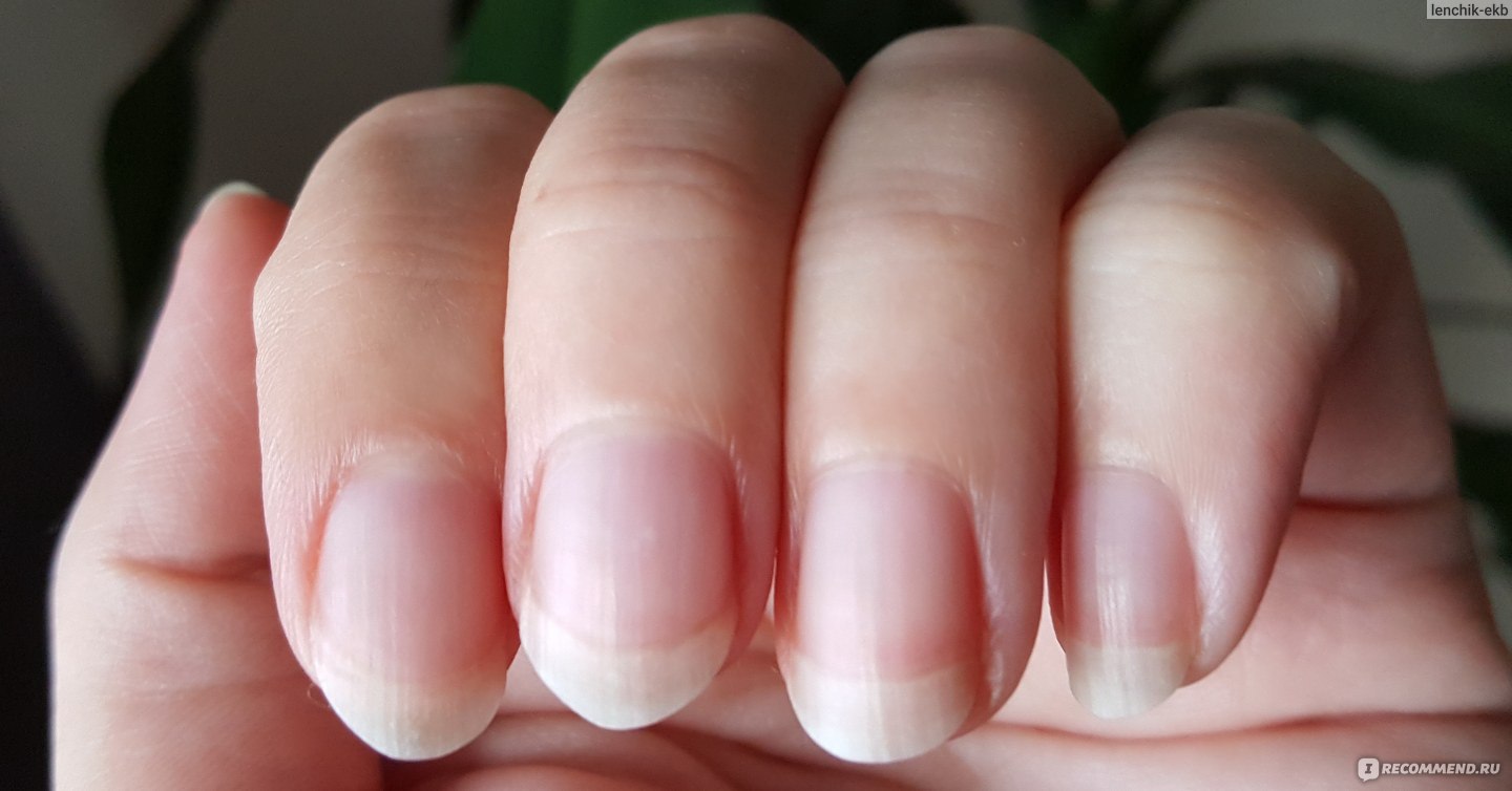 Почему ногти становятся волнистыми: 6 распространенных причин