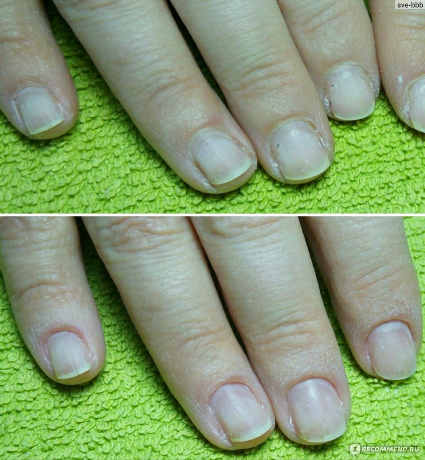 Ногти после аппаратного маникюра. Ногти до и после. Аппаратный маникюр до и после. Ногти до и после аппаратного маникюра.