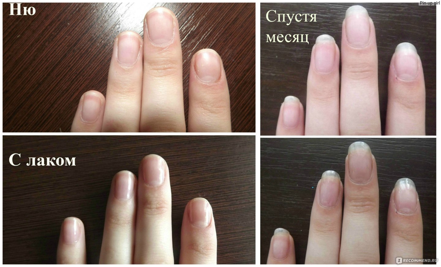 Ногти за месяц до и после