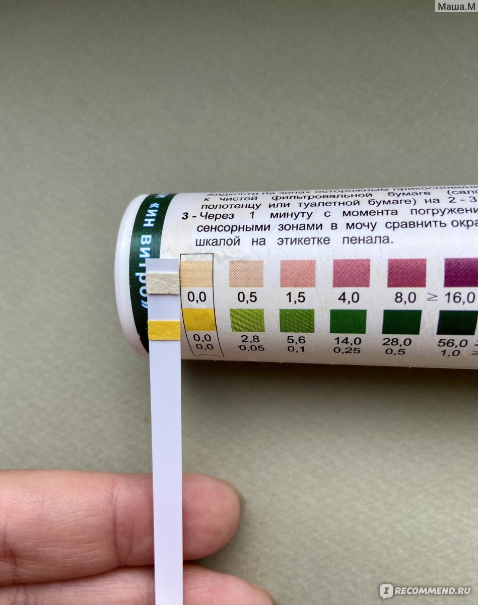 Полоски на определение кетоновых тел в моче ООО 