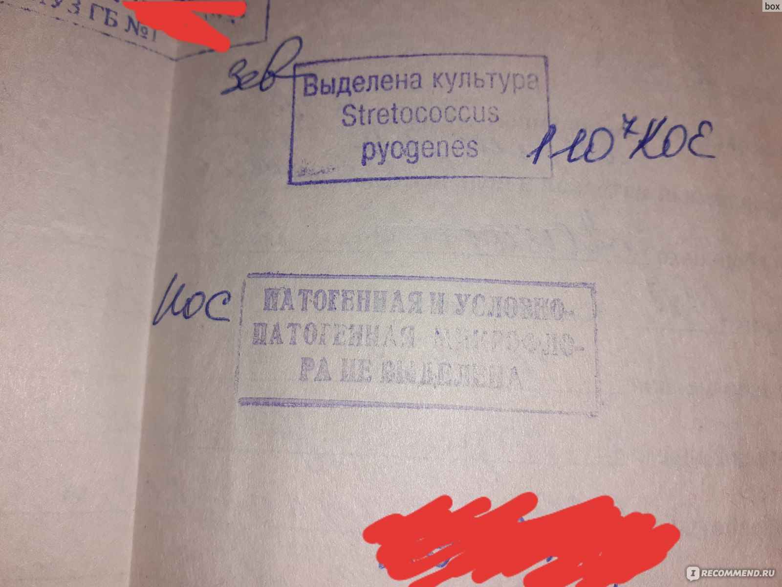 Анализ мазков из носа и зева на дифтерию