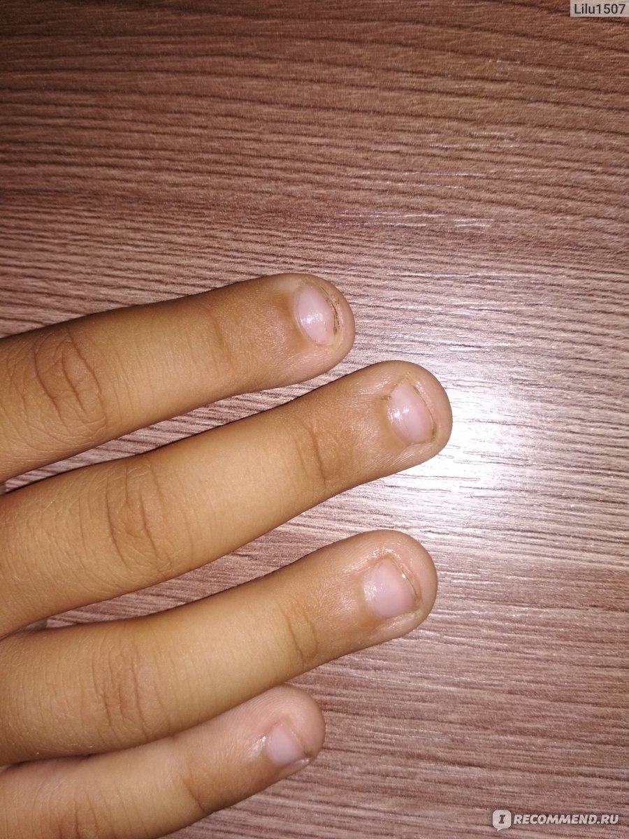 Ногти которые грызли в детстве