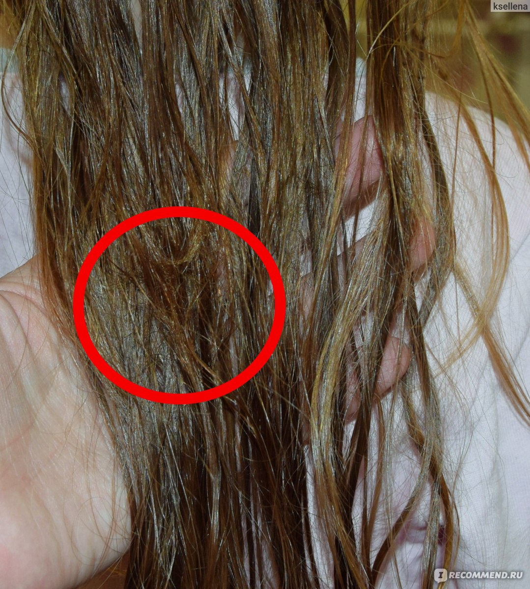 Сколько волос должно выпадать когда моешь голову