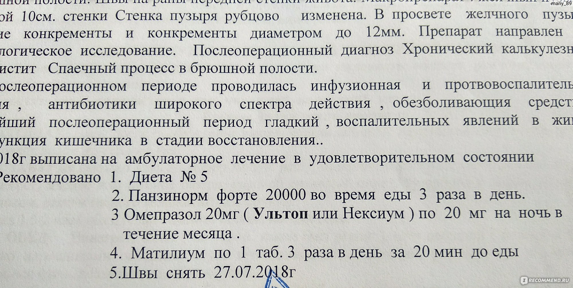 Лапароскопическая холецистэктомия. Удаление желчного пузыря при помощи  проколов - «Хорошо что сделала! Мои впечатления с фотографиями / отзыв  обновлен!» | отзывы