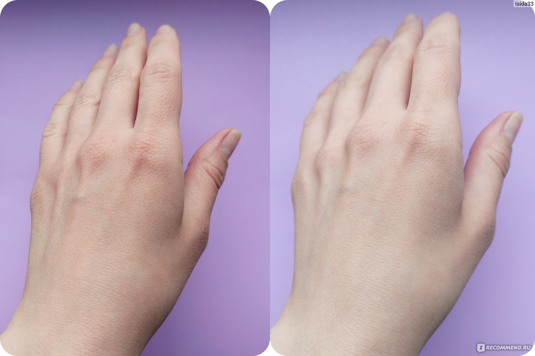 Кожа рук до и после нанесения крема