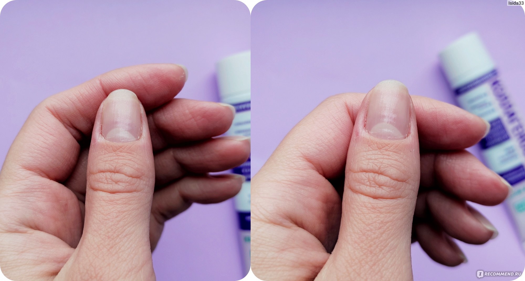Ногти до и после нанесения крема