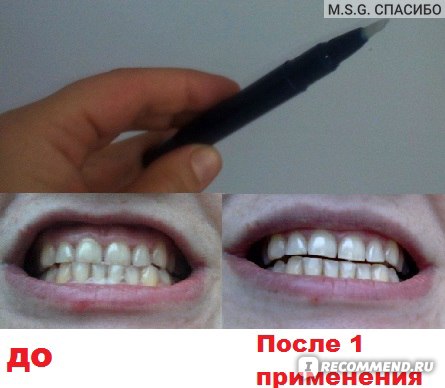 Инструкция На Teeth Whitening Pen