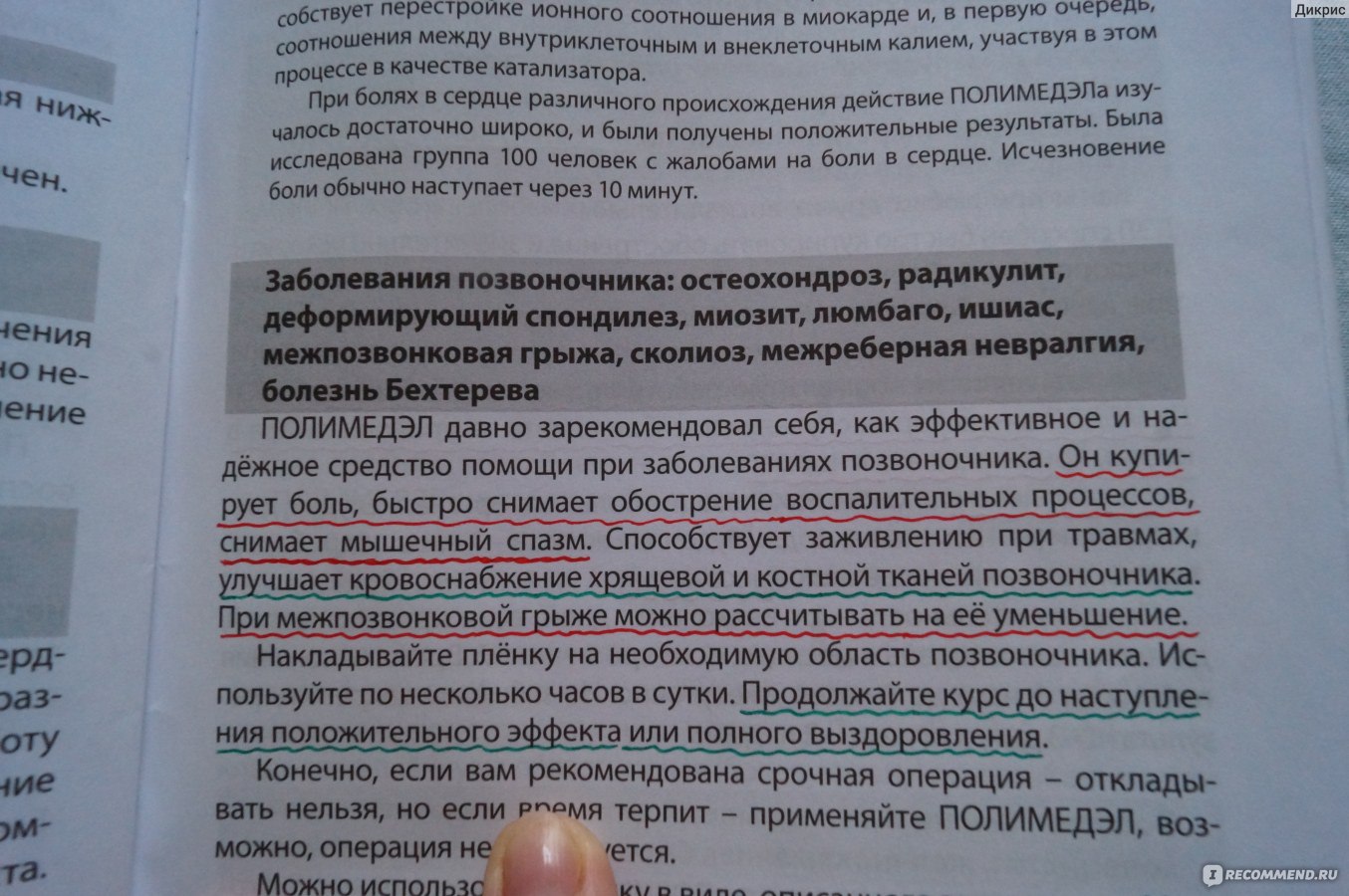 Димексид при грыже позвоночника. Полимедэл. Молитва при грыже позвоночника. Полимедэл для позвоночника. Кому молятся при болезнях позвоночника грыжа.