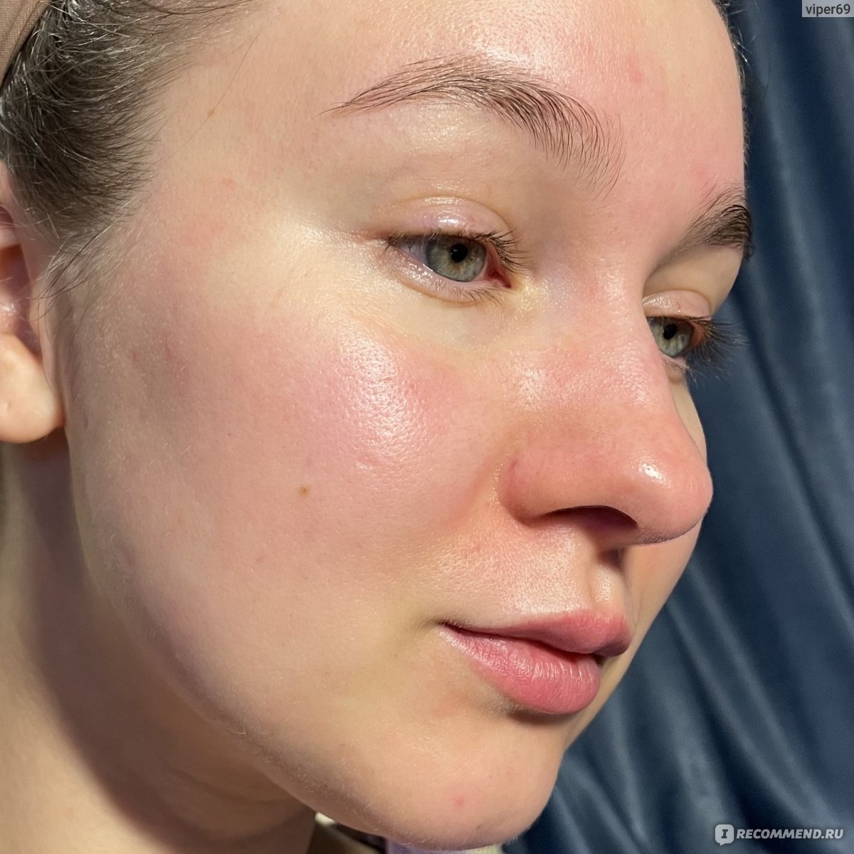 красивая кожа. девушка умывается. девушка протирает лицо. умывание для лица для проблемной кожи. после умывания лица что делать.