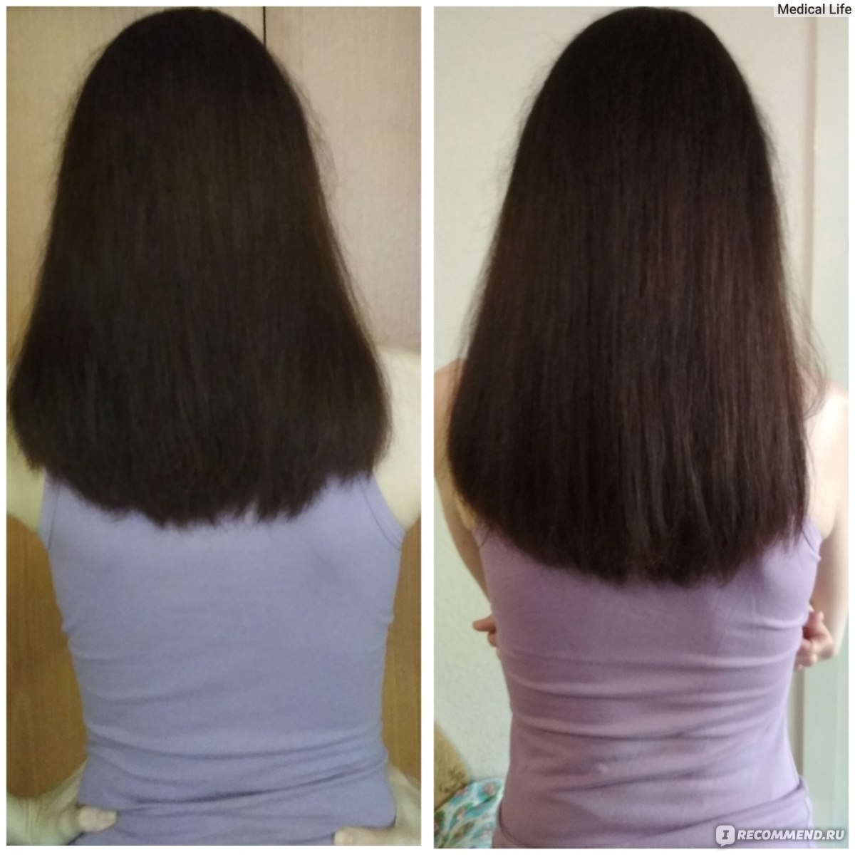 Фото роста волос по месяцам