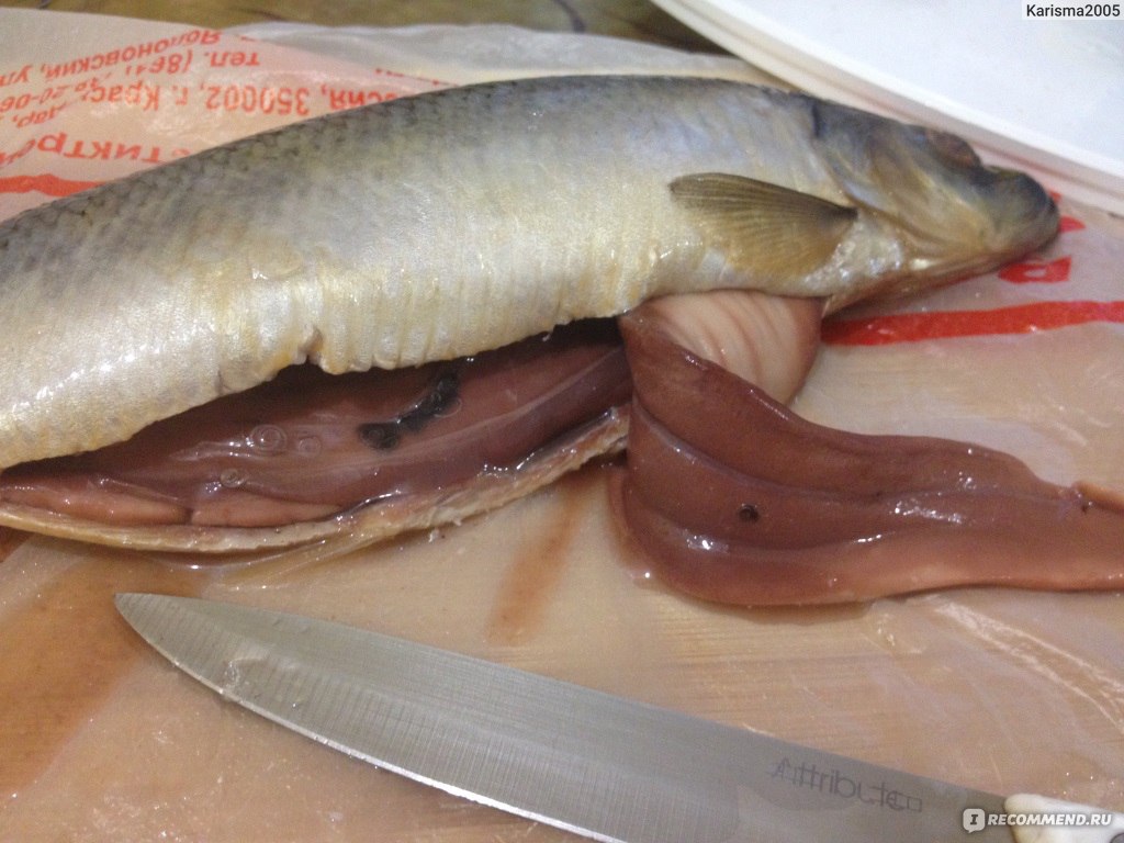 Человек съел много соленой рыбы. Личинки селёдочного червя (Anisakis Simplex).